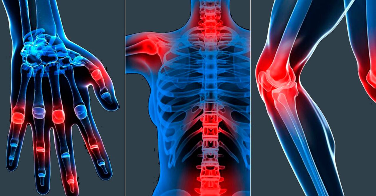Bosvelijos ekstrakto kapsulėse vartojimo indikacijos