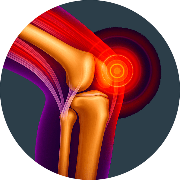 Sąnarių uždegimas